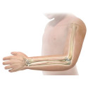 Activa IM - Nail™ - gwoździe do osteosyntezy