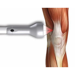 Nakładka skupiająca DILA (Polaris HP S/M)