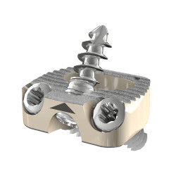 Stalif C Ti - Klatka szyjna