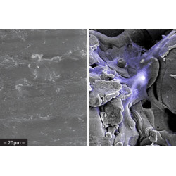 Stalif C Ti - Klatka szyjna