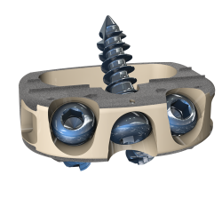 Stalif M Ti – Klatka lędźwiowa