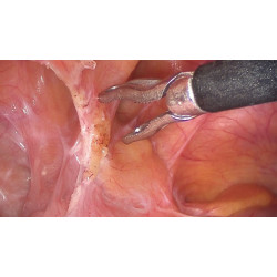 Panoview Ultra - optyka o wysokiej rozdzielczości