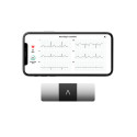 KardiaMobile 6L - przenośny monitor EKG