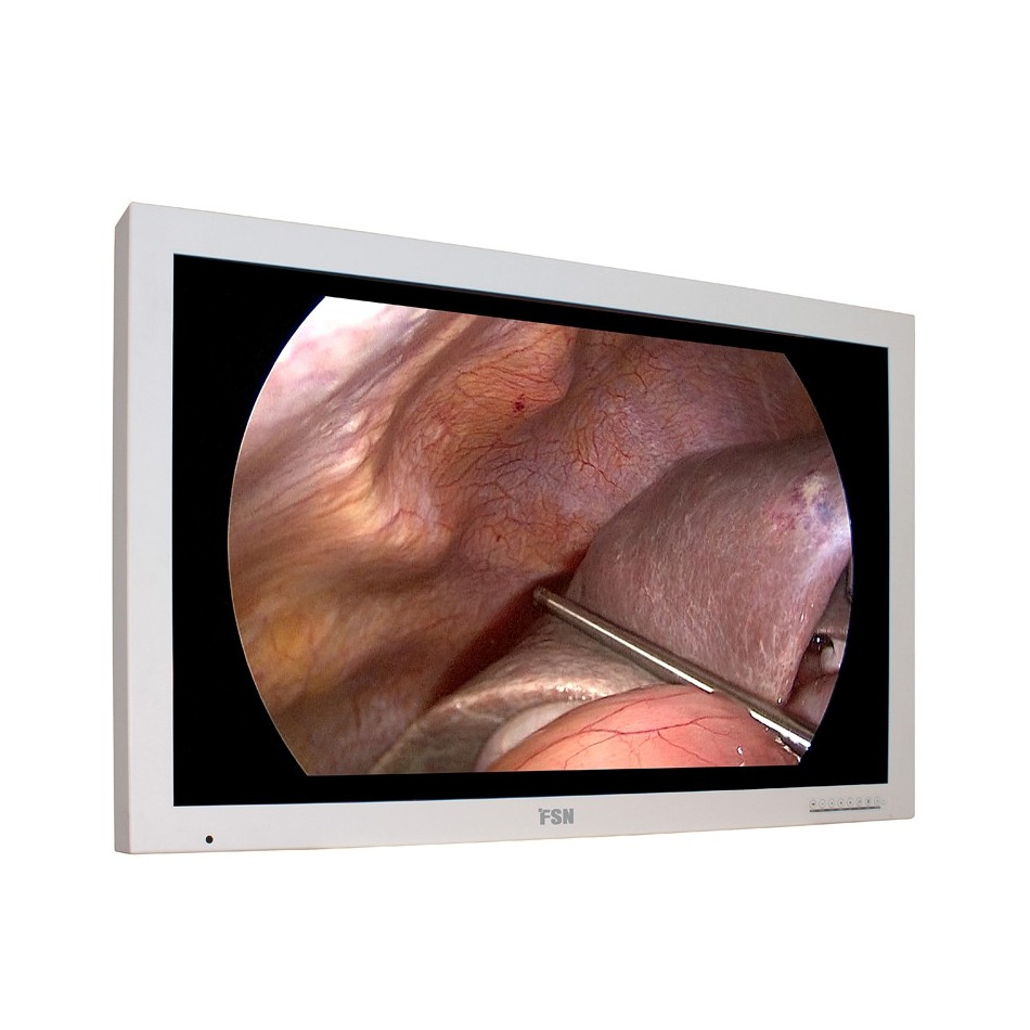 Monitor medyczny, zabiegowy Full-HD LED 55”