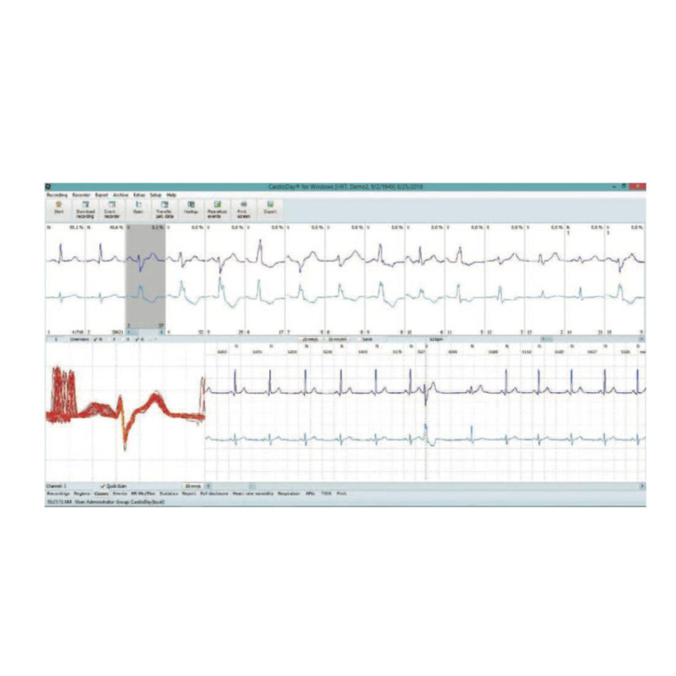 Oprogramowanie do holtera CardioDay