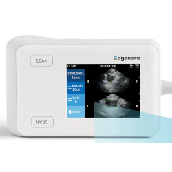 EdgeFlow - skaner pęcherza moczowego