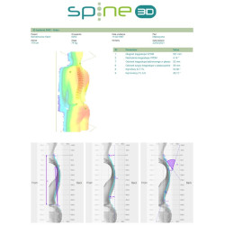 Spine 3D - System analizy postawy ciała Spine 3D - System analizy postawy ciała