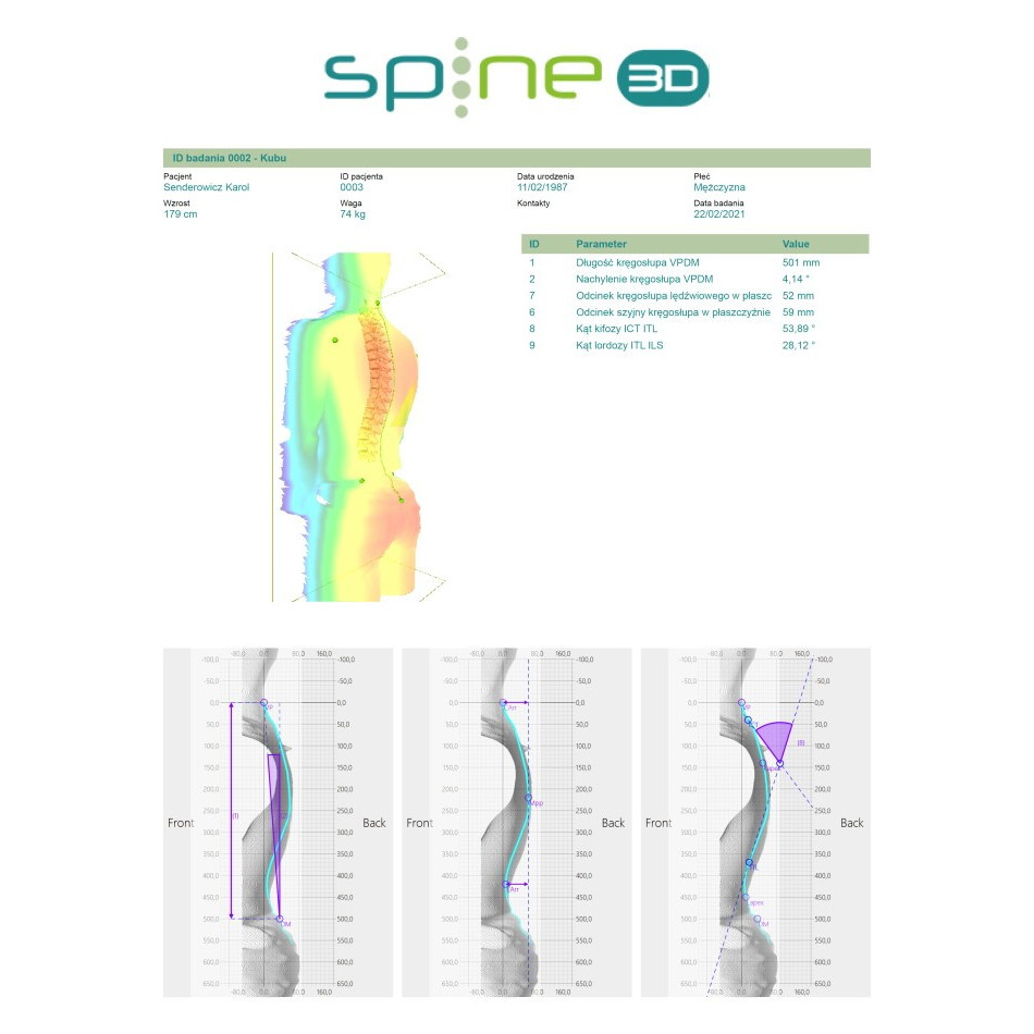Spine 3D - System analizy postawy ciała Spine 3D - System analizy postawy ciała