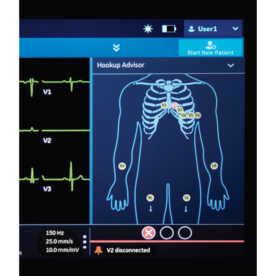 Aparat EKG MAC 5 A4 firmy GE HealthCare - OUTLET