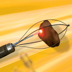 Koszyk nitinolowy Dormia Escape Koszyk nitinolowy Dormia Escape