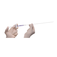 Leczenie odpływów pęcherzowo-moczowodowych