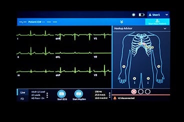 Technologia Smart Lead automatycznie wykrywa, jeśli doszło do rozłączenia elektrody.