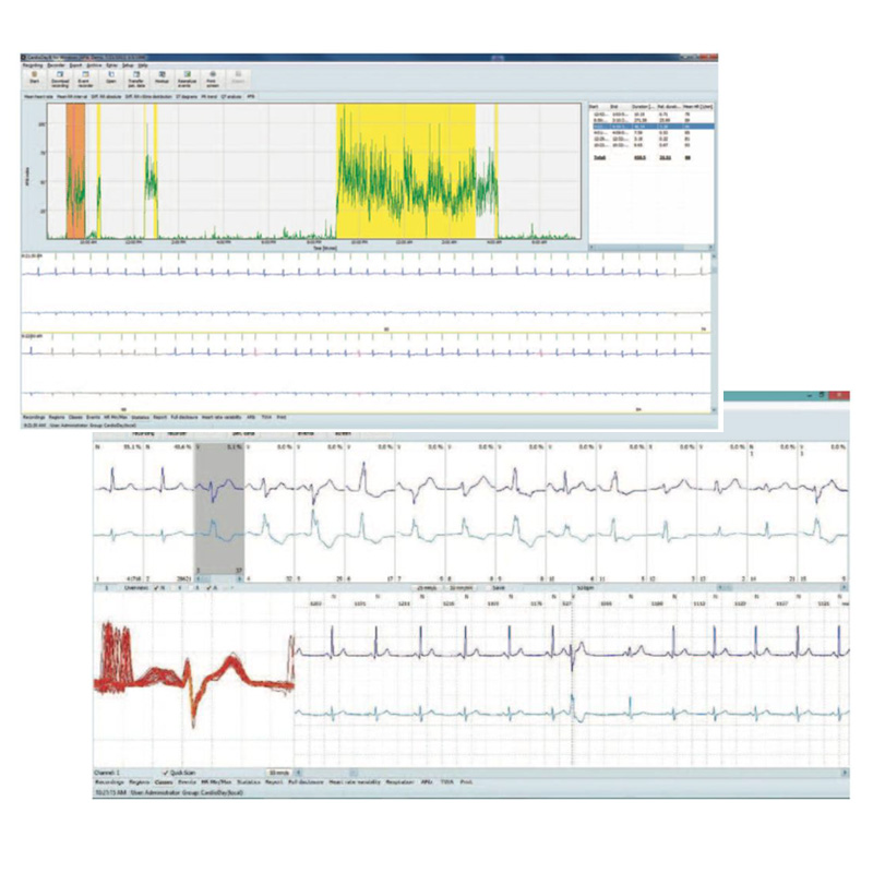 Oprogramowanie do holtera CardioDay