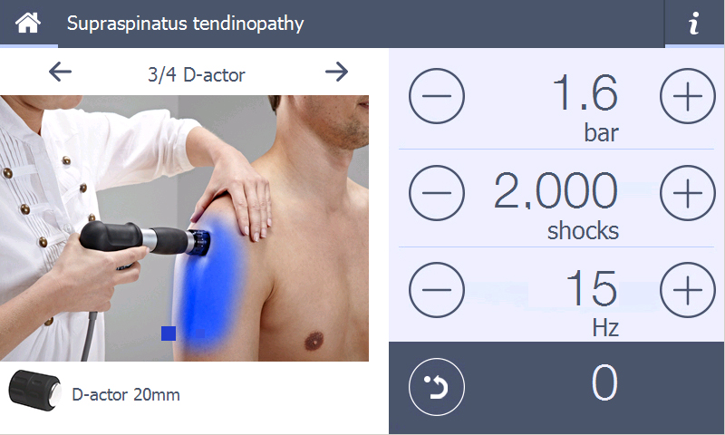 Protokół leczenia tendinopatii mięśnia ścięgna nadgrzebieniowego w aparacie ShockMaster 500