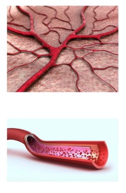 Zastosowanie fali uderzeniowej w leczeniu zaburzeń erekcji