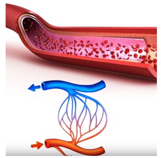 Sposób działania ESWL