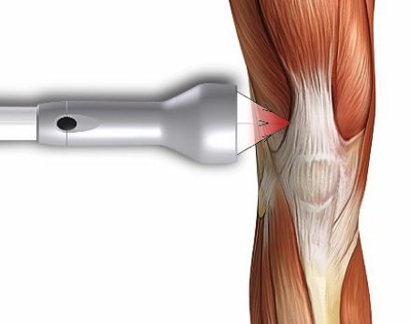 Nakładka skupiająca DILA (Polaris HP S/M)