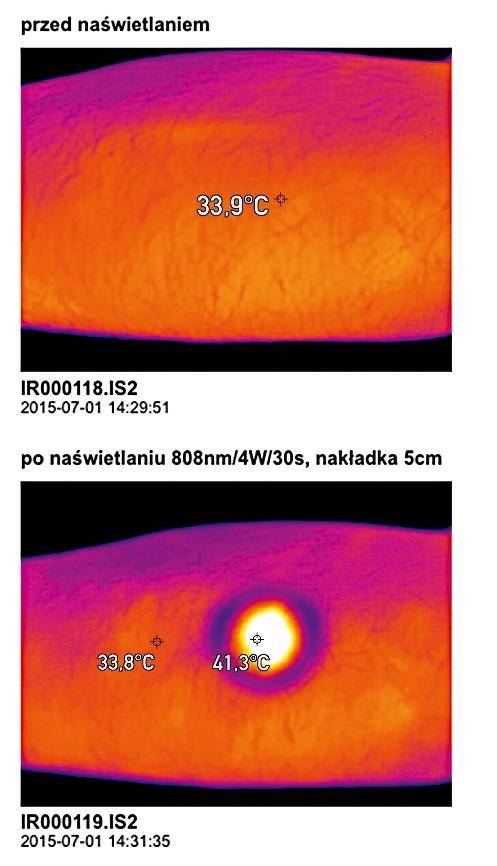 Nakładka skupiająca