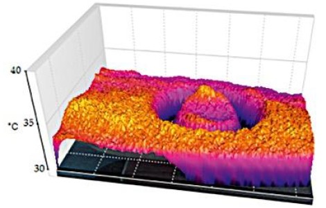 Nakładka skupiająca DILA