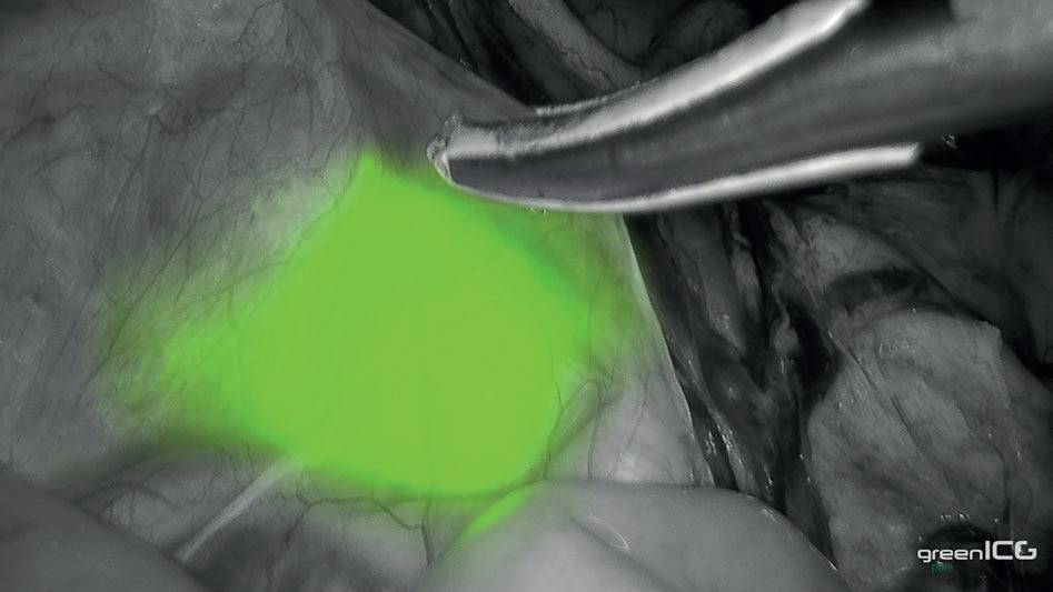 greenICG pure - System Green ICG