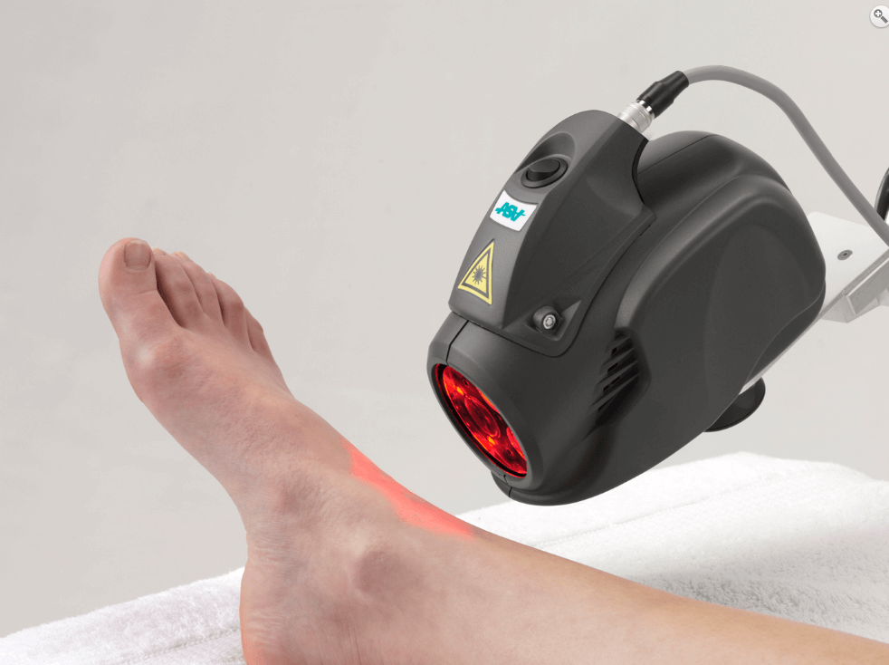 Zastosowanie terapii MLS - lasery wysokoenergetyczne