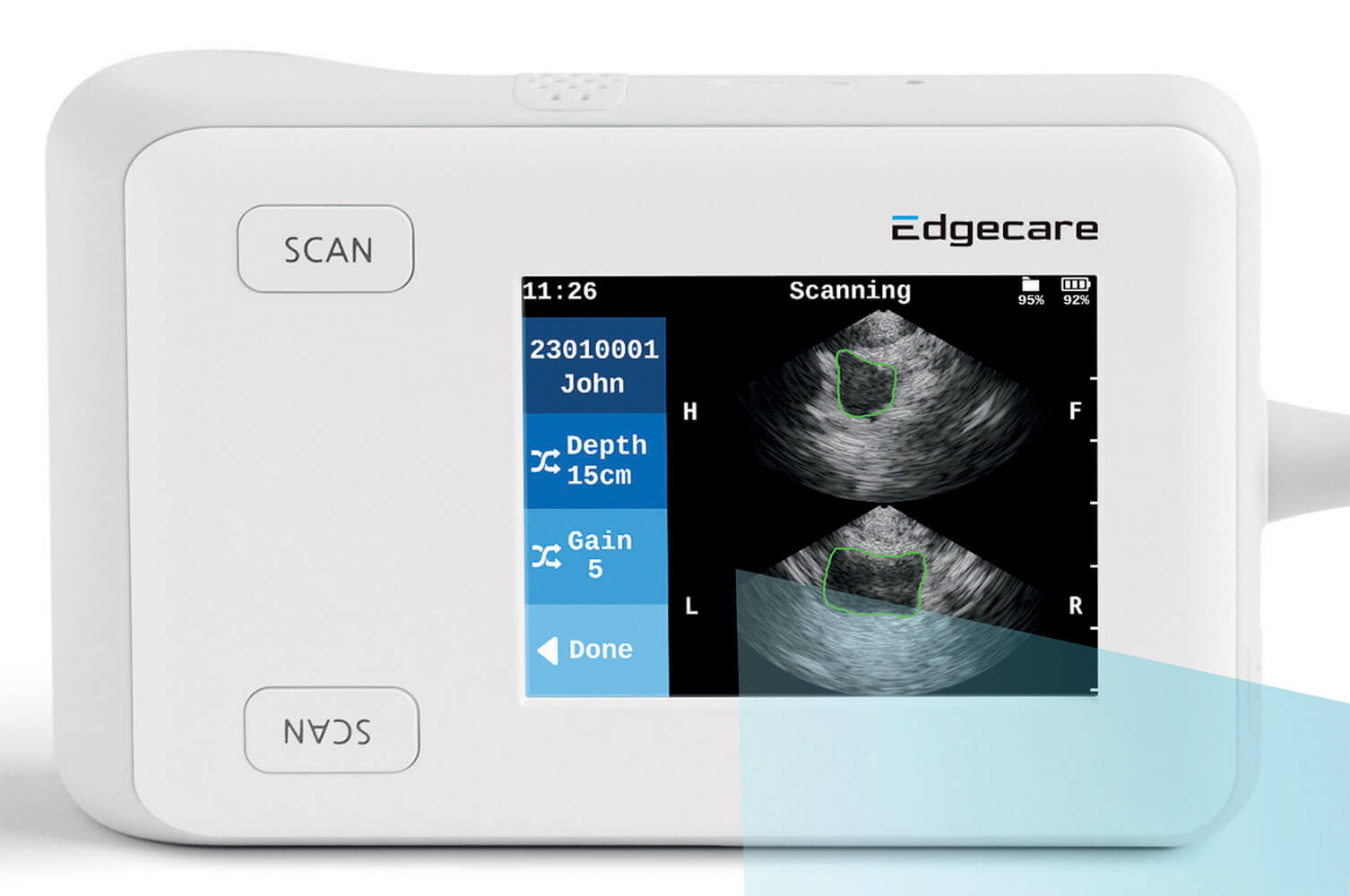 EdgeFlow - skaner pęcherza moczowego