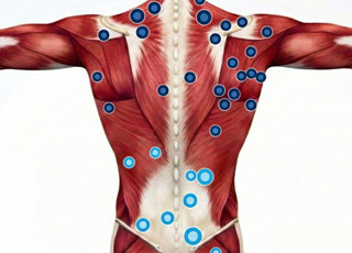 Zapalenie powięzi – dlaczego ból nie mija? Przewodnik po nowoczesnej rehabilitacji